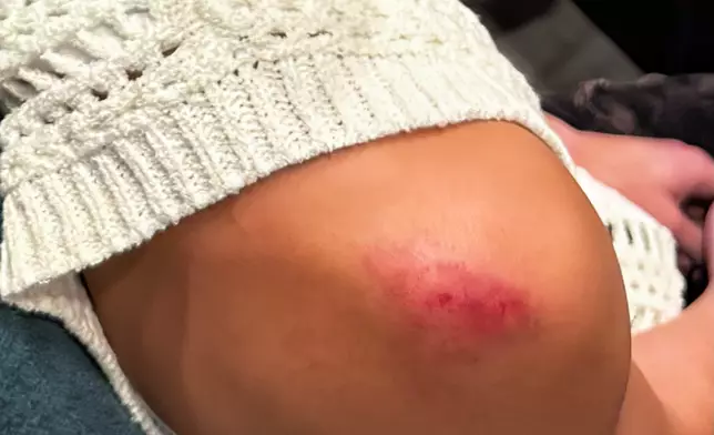 翻騰傷膊仍搏盡無悔。