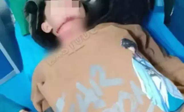 河南翁私裝繩索防粟米被破壞，13歲少年騎單車遭「割喉」一段氣管仍未尋回。微博影片截圖