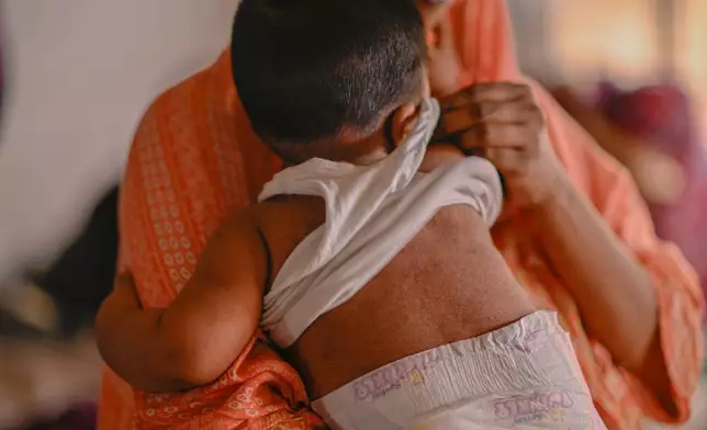 2026年4月6日周一，孟加拉國達卡傳染病醫院，一名婦女安慰正在接受麻疹治療的兒童，當時全國正爆發麻疹疫情。(美聯社圖片/Mahmud Hossain Opu) AP圖片