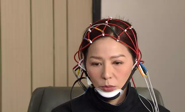 熊家上下帶熊尚善去睇腦科醫生。