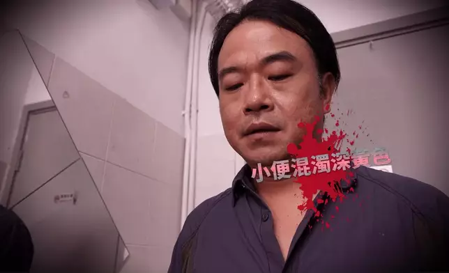 今集個案主角係李啟傑，演繹咗四大肝癌微兆。