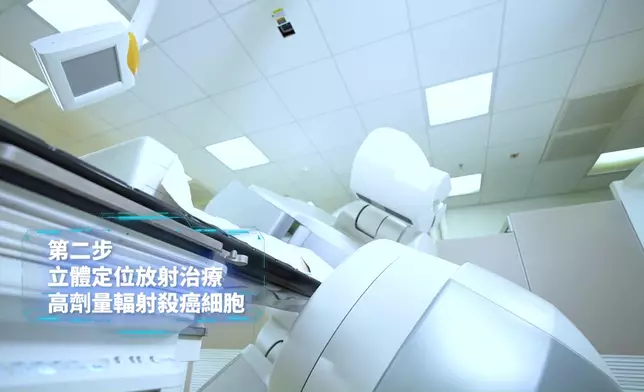 解構「先縮後除」肝癌治療新技術三大步驟。