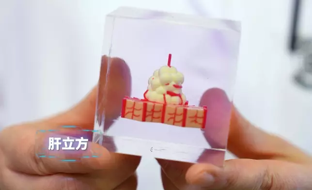 3D打印肝立方，幫助病患找出最佳治療方針。