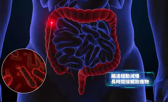 國際知名的腸胃病學專家陳家亮教授節目中將拆解大腸癌的真正成因，以及如何全面預防這項癌症。