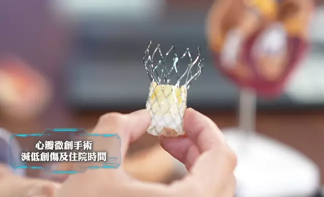 心瓣微創手術可以減低創傷及住院時間。