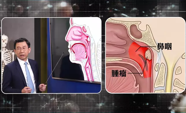 中大醫學院化學病理學系系主任陳君賜教授。