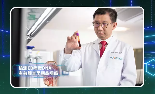 陳君賜教授指出早期鼻咽癌無明顯病徵。