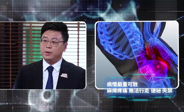「椎間盤突出」嚴重可引致失禁。