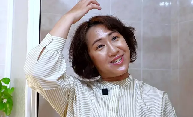 原本覺得掉頭髮很小事的鄭醫生，當親身經歷過後，才明白箇中的痛。