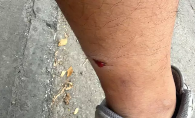 傷者左腳被唐狗咬傷。