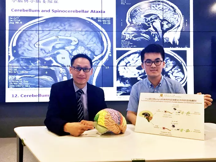 中文教授陳浩然及研究團隊最近發現形成小腦萎縮症三型的致病原因，有助研發藥物治癒。