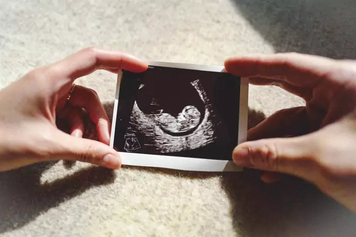 張寶兒於IG上載一張超聲波相報喜，宣佈懷孕獲得網民祝福！