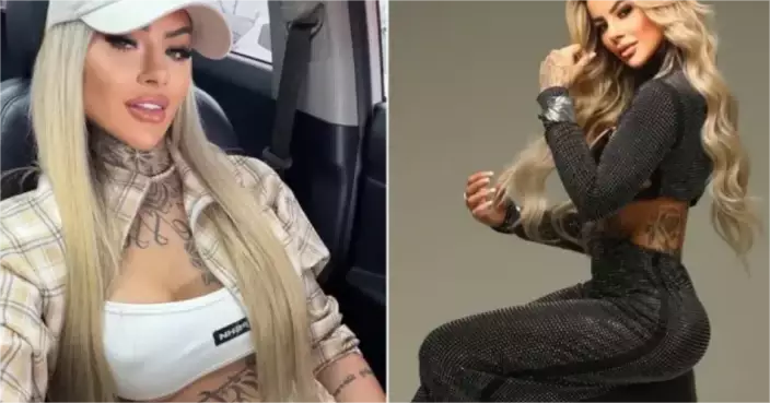 27歲巴西網紅比安卡在接受隆胸抽脂手術18天後，因肺栓塞併發癲癇不幸猝逝。Instagram/@_biancadias 圖片