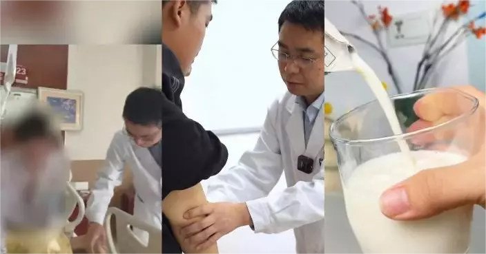 上海男子因誤飲過期牛奶，導致腸阻塞，體重暴跌 26.5 公斤。影片截圖