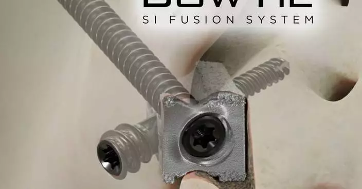 SAIL Fusion Announces FDA Clearance of its BowTie™ Sacroiliac Fusion System