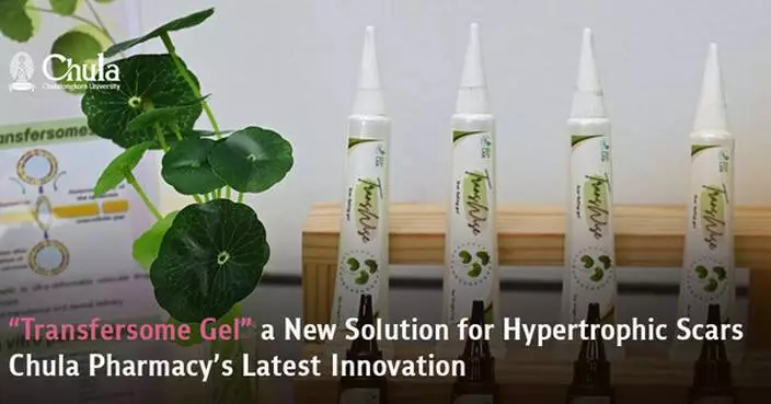 &#8220;Transfersome Gel&#8221; a New Solution for Hypertrophic Scars Chula Pharmacy&#8217;s Latest Innovation