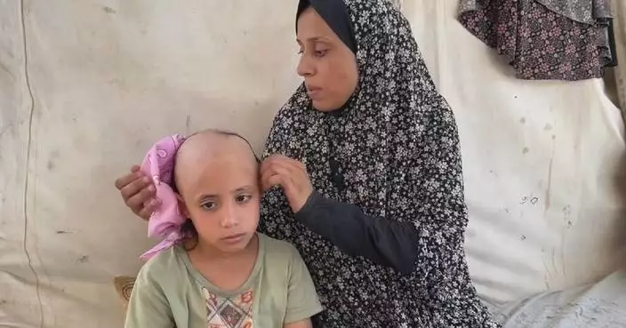 Continuing conflict takes toll as young Gaza girl loses hair due to stress of war