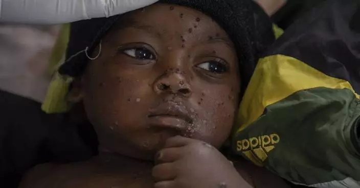 A gold mining town in Congo has become an mpox hot spot as a new strain spreads