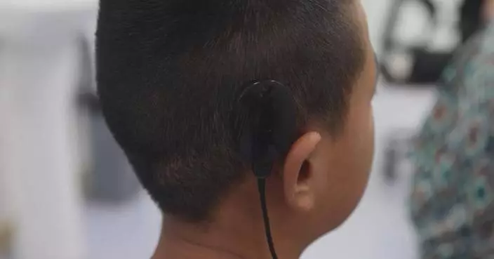 China to include cochlear implants in centralized procurement to ease patient burden