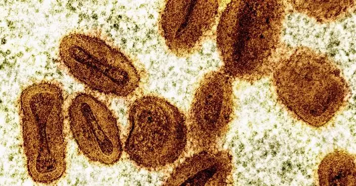 US health officials report 1st case of new form of mpox in a traveler