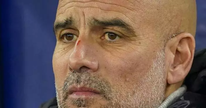 Head-scratcher: Pep Guardiola has marks on his nose and head after latest bad Man City result