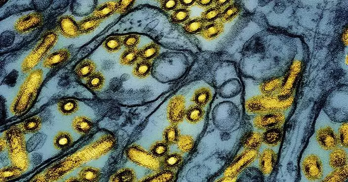 Health officials say Louisiana patient is first severe bird flu case in US