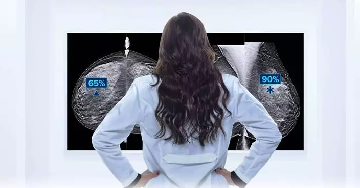 Hologic Presents New Research Demonstrating How Its Breast Imaging AI Solution Performs Similarly Across Diverse Populations