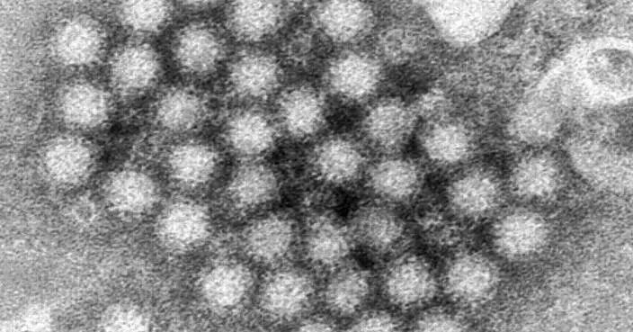 Nasty norovirus is back in full force with US cases of the stomach virus surging