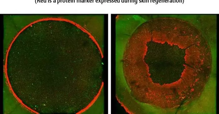 Amorepacific Research Confirms Potential of Microalgal-Derived PDRNs in Skin Regeneration and Wound Healing