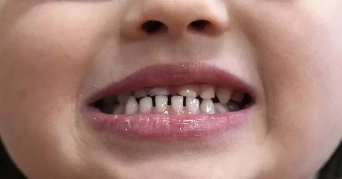 FDA and RFK Jr. aim to remove fluoride supplements used to protect kids&#8217; teeth