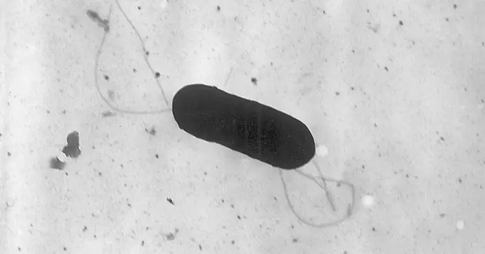 At least 10 people sickened in US listeria outbreak linked to prepared foods