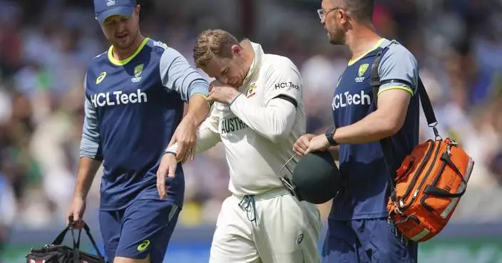 Australia batter Steve Smith out of WTC final after breaking pinkie
