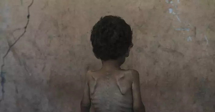 Israel's leader claims no one in Gaza is starving. Data and witnesses disagree