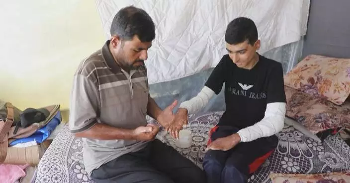 Palestinian teen burned in Gaza airstrike battles ongoing pain nearly year later