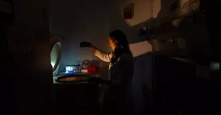 PHOTO ESSAY: Scientists trying to unravel one of the body’s biggest mysteries