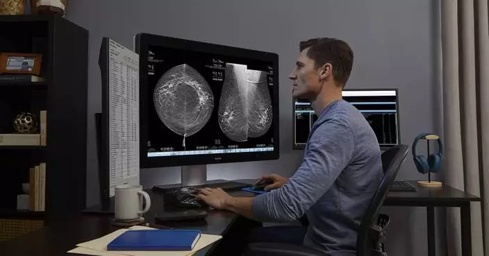 Hologic’s AI-Powered Mammography Technology Flagged a Third of Breast Cancer Cases Initially Interpreted as Negative in Study of 7,500 Screening Exams