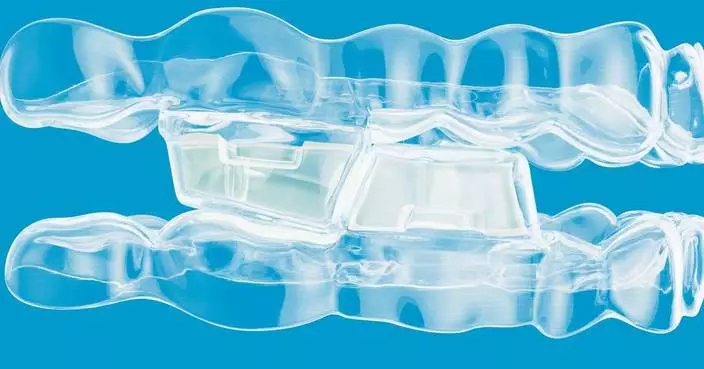 Align Technology Announces Invisalign® System With Mandibular Advancement Featuring Occlusal Blocks for Class II Skeletal and Dental Correction