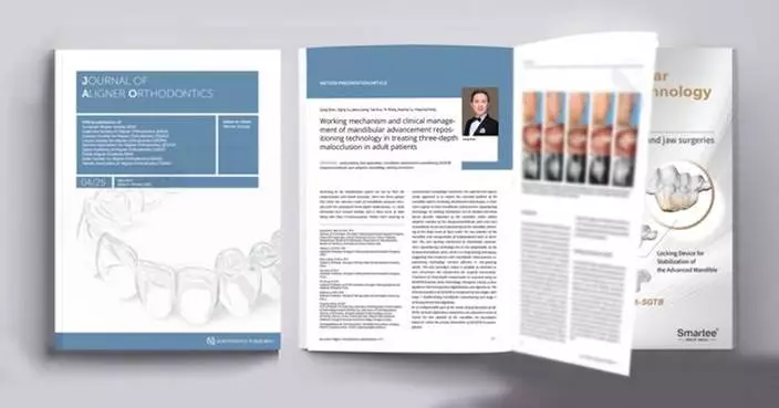 Prof. Gang Shen's Research Paper about Mandibular Advancement Repositioning Technology in the Journal of Aligner Orthodontics
