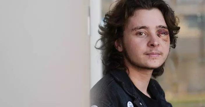 California protester left blind in one eye is among string of violent run-ins with federal agents