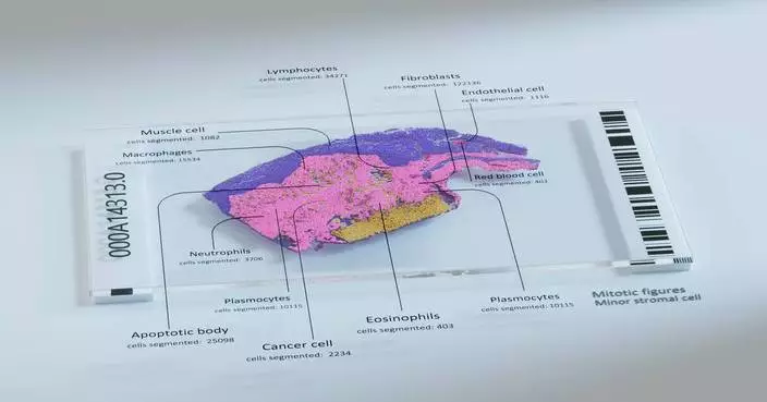 Owkin’s Specialized Biological AI Agent Pathology Explorer Launches with Anthropic’s Claude for Healthcare and Life Sciences
