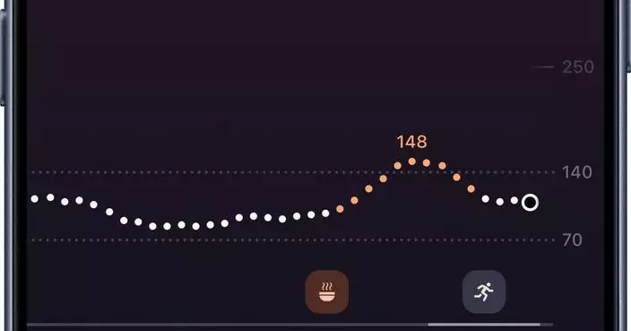 Dexcom Enters Next Era of Continued Innovation With Jake Leach as President and Chief Executive Officer
