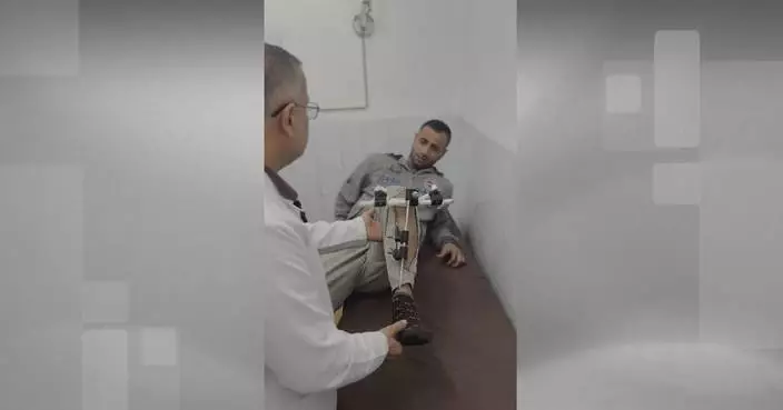 3D printing technology brings hope to wounded patients in Gaza