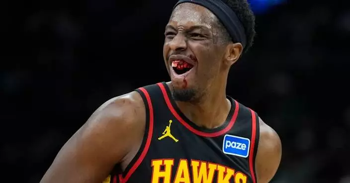 Onyeka Okongwu has a dental fracture after elbow to the face and will miss Hawks' game vs. Rockets