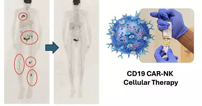 ImmunityBio Announces Durable Complete Response of 15 Months with a Chemotherapy-Free CD19 CAR-NK Cell Therapy in Waldenstrom Lymphoma
