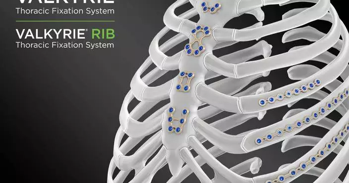 Able Medical to Showcase Industry’s First-to-Market PEEK Sternal Closure System at STS