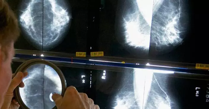 Pandemic disruptions to health care worsened cancer survival, study suggests