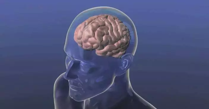 Chinese scientists identify core brain network underlying Parkinson’s disease, enabling better treatment