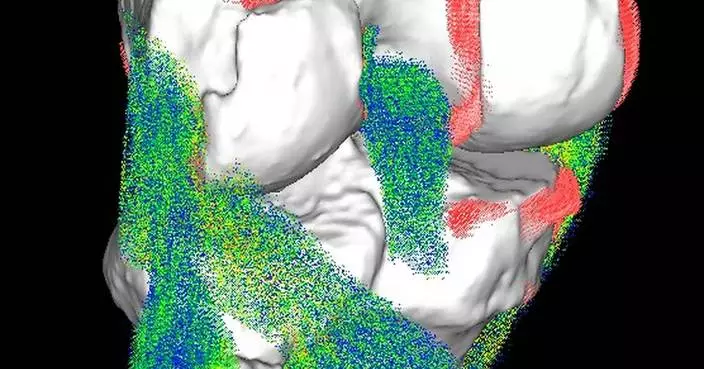 Vent Creativity Appoints Paul Abrams as Vice President of Sales to Lead Commercial Growth