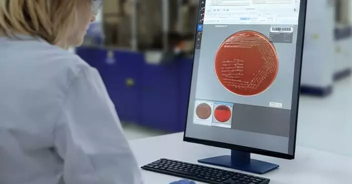 FDA 510(k) Clearance Establishes Broad Intended Use for Copan's PhenoMATRIX®, Expanding Clinical Microbiology Capabilities