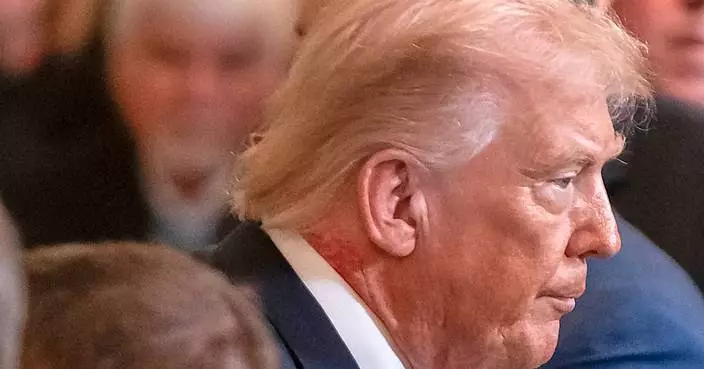 Redness on Trump’s neck is caused by common skin cream, White House says